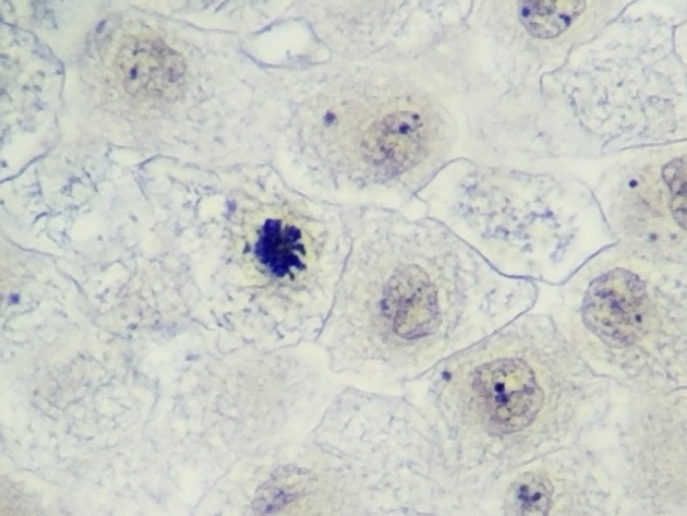 White Fish Mitosis Slides - White Fish Mitosis 06 400X